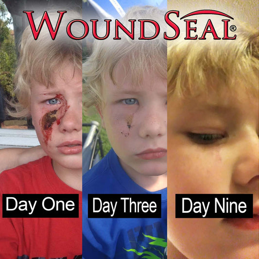 WoundSeal Stop Bleeding Instantly