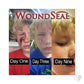 WoundSeal with 4 Applicators and Powders Face Wound